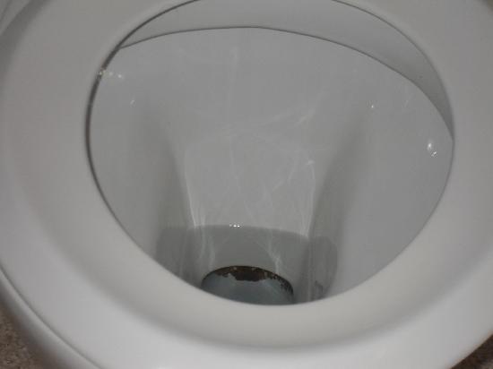 dirty-toilet-bowl